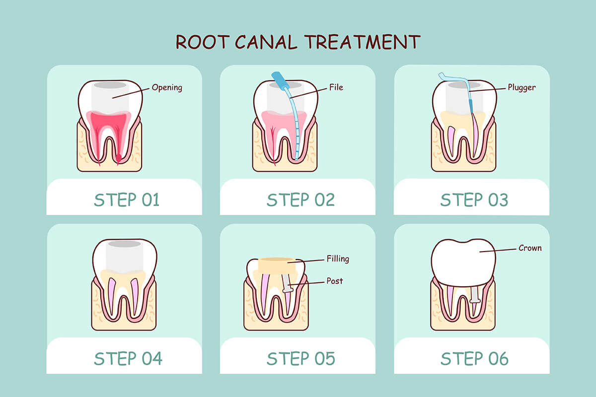 Springtown TX Dental Office