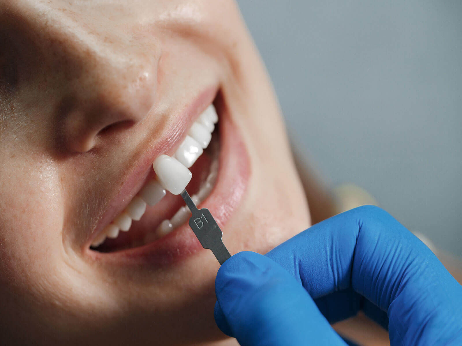 The Longevity of Dental Crowns: Maintenance And Care Tips