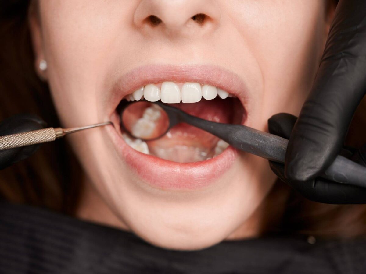 Why Regular Oral Cancer Screenings Should Be Part of Your Annual Dental Checkup