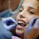 The Benefits of Early Orthodontic Intervention