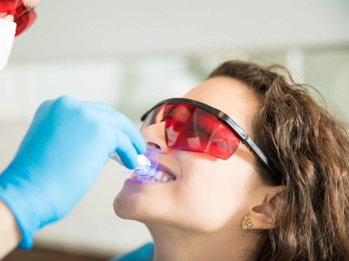 5 Benefits of Professional Teeth Whitening