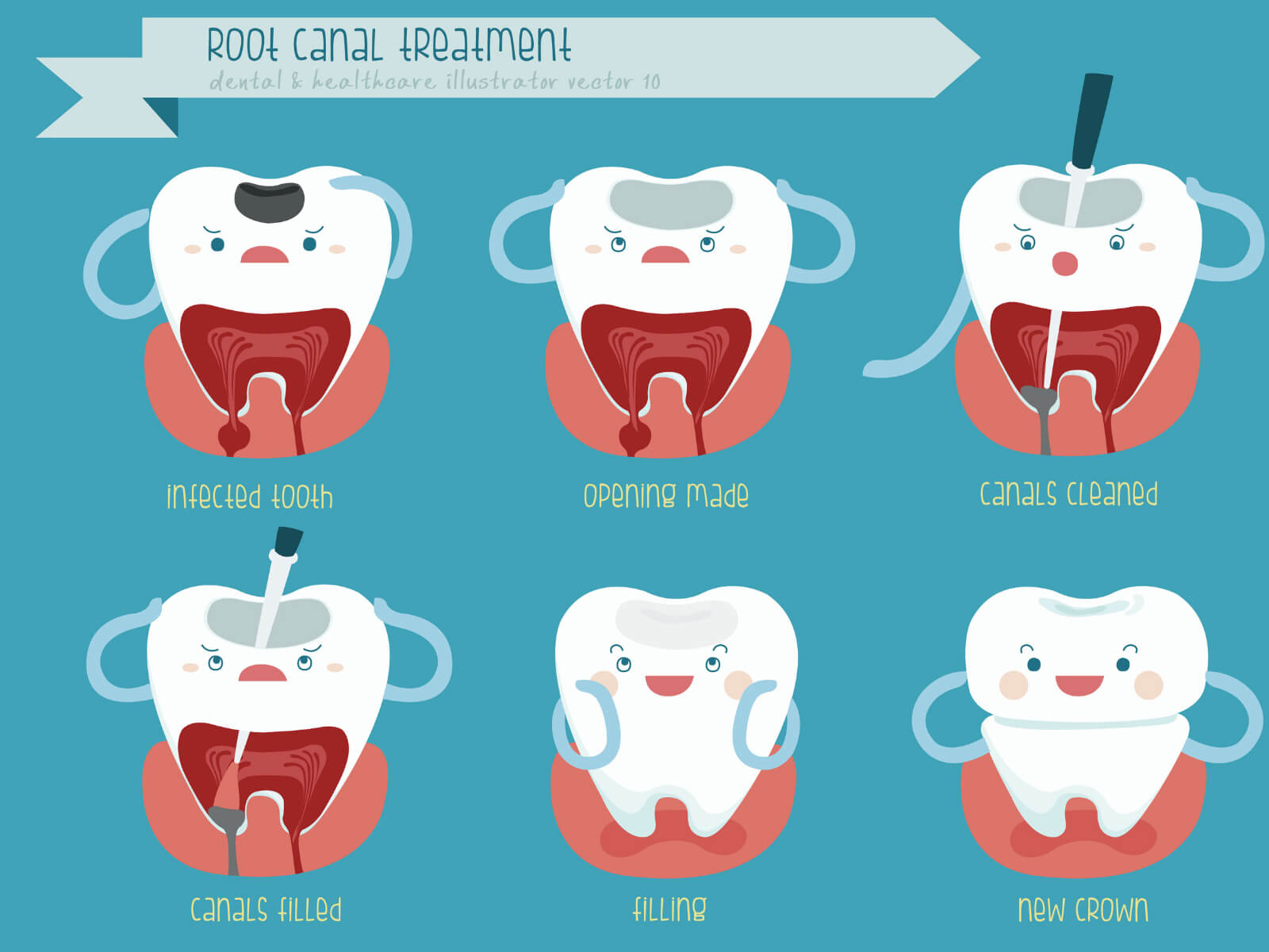 Root Canal Vs. Extraction: Which Option Saves Your Smile?