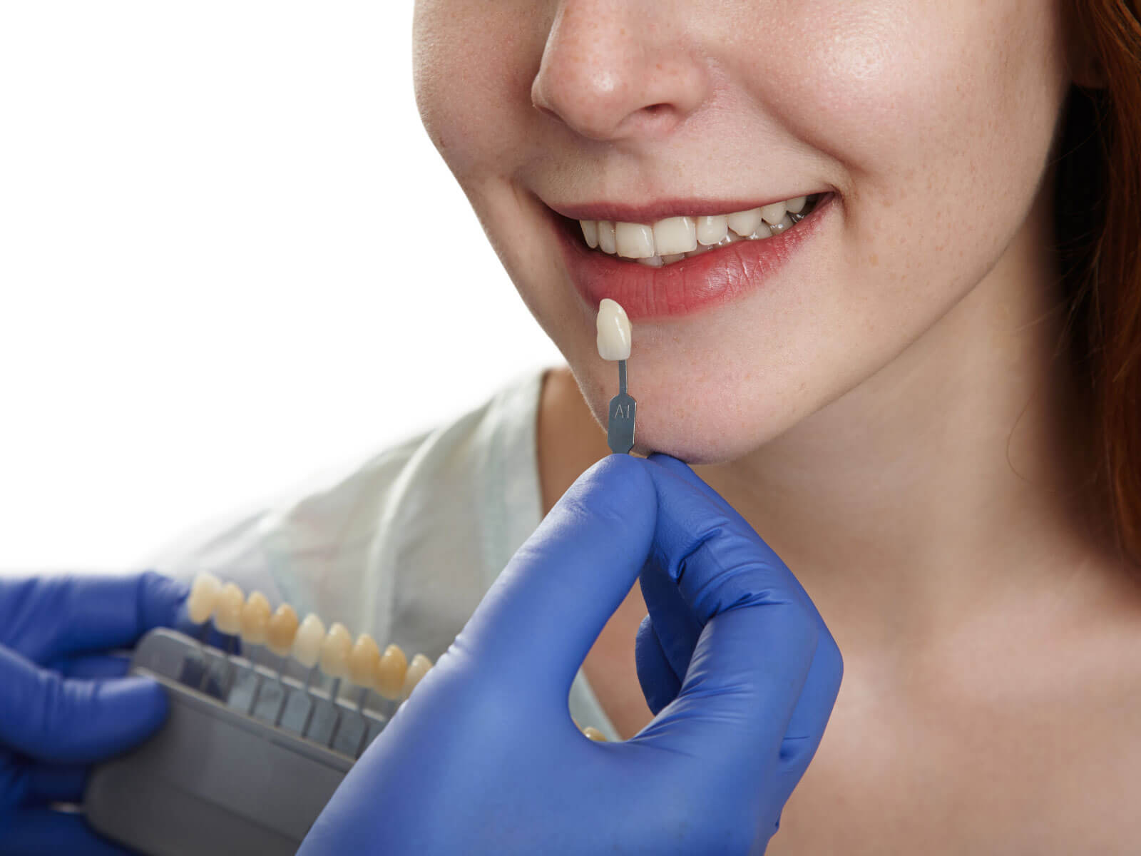 7 Disadvantages of Dental Crowns You Should Know