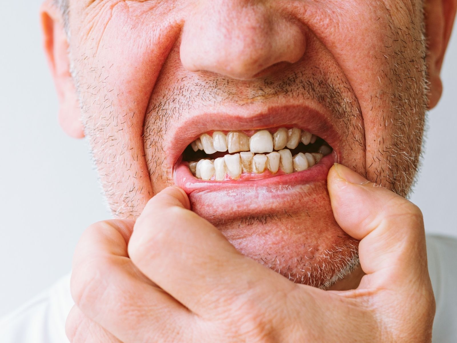 Early Signs of a Tooth Infection You Should Never Ignore